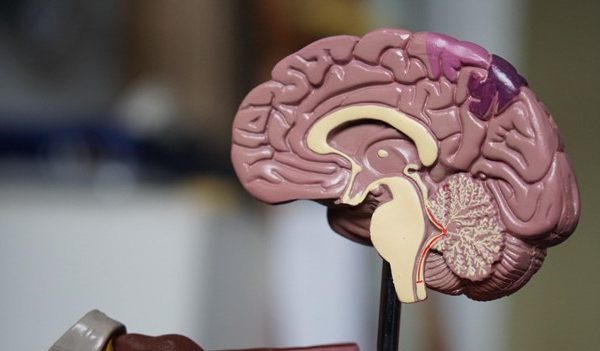 A picture of a 3-D diagram of a brain; Residents Medical Group advocates for Alzheimer’s research